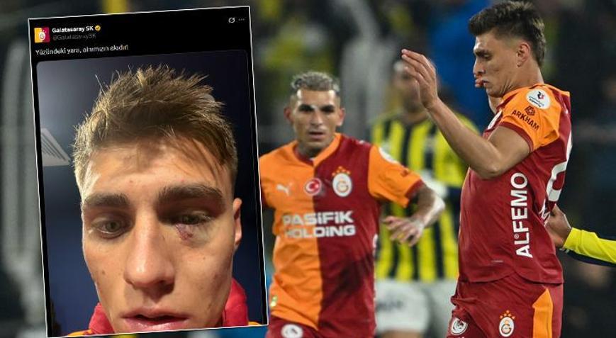 Galatasaray’dan Kazımcan Karataş mesajı: Fenerbahçe derbisi sonrası “Alnımızın akıdır” paylaşımı - Spordan Haberler Galatasaray’dan Kazımcan Karataş mesajı: Fenerbahçe derbisi sonrası “Alnımızın akıdır” paylaşımı